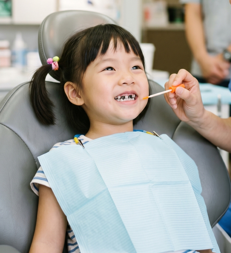 Silver Diamine Fluoride (SDF) 